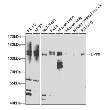 Western Blot - Anti-DPP8 Antibody (A15549) - Antibodies.com