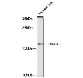 Western Blot - Anti-TXNL4B Antibody (A15550) - Antibodies.com