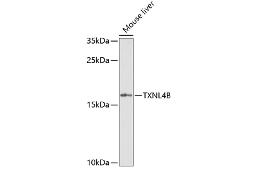 Western Blot - Anti-TXNL4B Antibody (A15550) - Antibodies.com