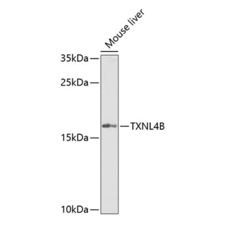 Western Blot - Anti-TXNL4B Antibody (A15550) - Antibodies.com