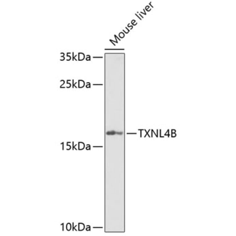 Western Blot - Anti-TXNL4B Antibody (A15550) - Antibodies.com