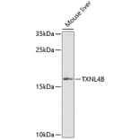 Western Blot - Anti-TXNL4B Antibody (A15550) - Antibodies.com