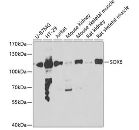 Western Blot - Anti-SOX6 Antibody (A15551) - Antibodies.com