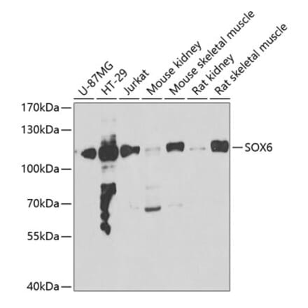 Western Blot - Anti-SOX6 Antibody (A15551) - Antibodies.com