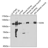 Western Blot - Anti-SOX6 Antibody (A15551) - Antibodies.com