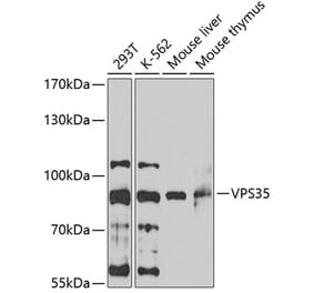 Western Blot - Anti-VPS35 Antibody (A15552) - Antibodies.com