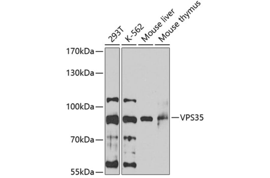 Western Blot - Anti-VPS35 Antibody (A15552) - Antibodies.com