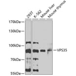 Western Blot - Anti-VPS35 Antibody (A15552) - Antibodies.com