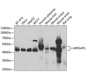Western Blot - Anti-ARFGAP1 Antibody (A15553) - Antibodies.com