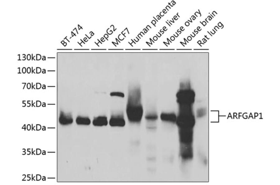 Western Blot - Anti-ARFGAP1 Antibody (A15553) - Antibodies.com