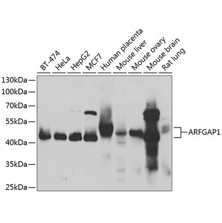 Western Blot - Anti-ARFGAP1 Antibody (A15553) - Antibodies.com