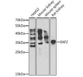 Western Blot - Anti-EAF2 Antibody (A15554) - Antibodies.com