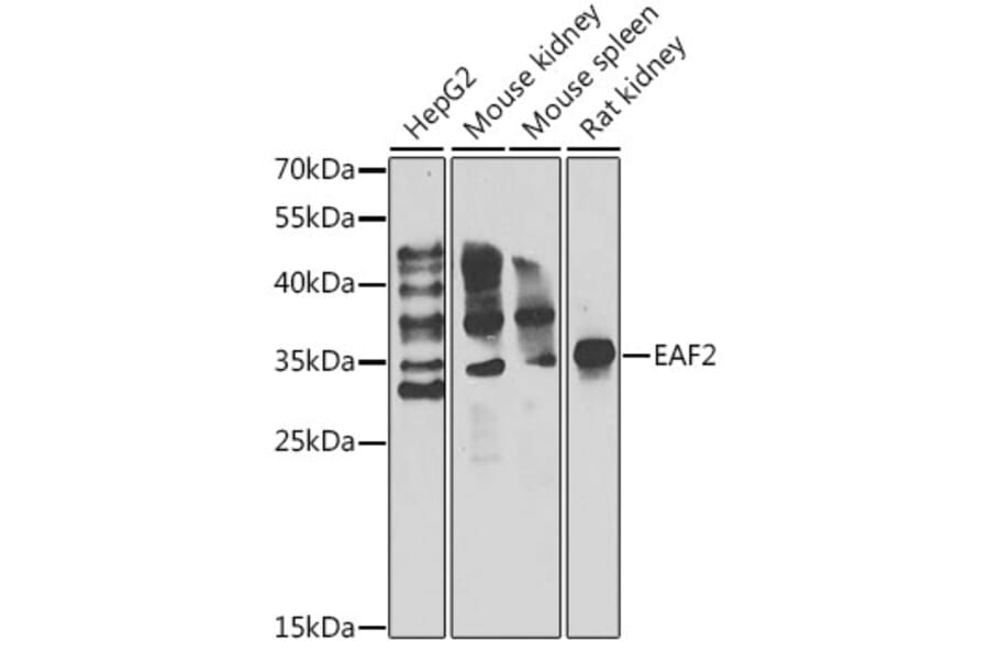 Western Blot - Anti-EAF2 Antibody (A15554) - Antibodies.com