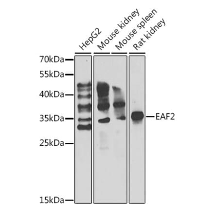 Western Blot - Anti-EAF2 Antibody (A15554) - Antibodies.com