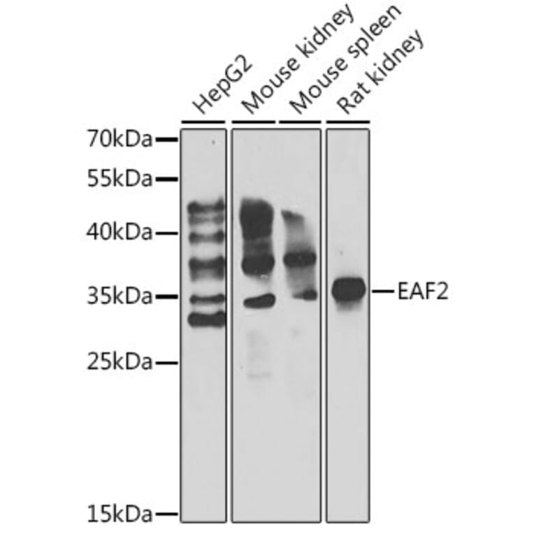 Western Blot - Anti-EAF2 Antibody (A15554) - Antibodies.com