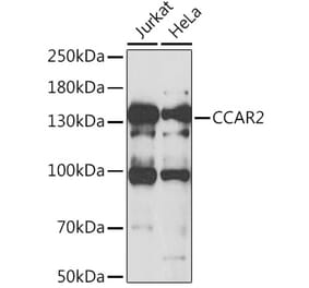 Western Blot - Anti-DBC-1 Antibody (A15555) - Antibodies.com