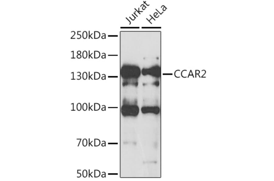 Western Blot - Anti-DBC-1 Antibody (A15555) - Antibodies.com