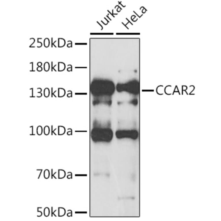 Western Blot - Anti-DBC-1 Antibody (A15555) - Antibodies.com