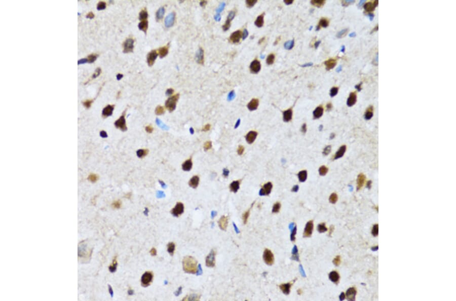 Immunohistochemistry - Anti-DBC-1 Antibody (A15555) - Antibodies.com