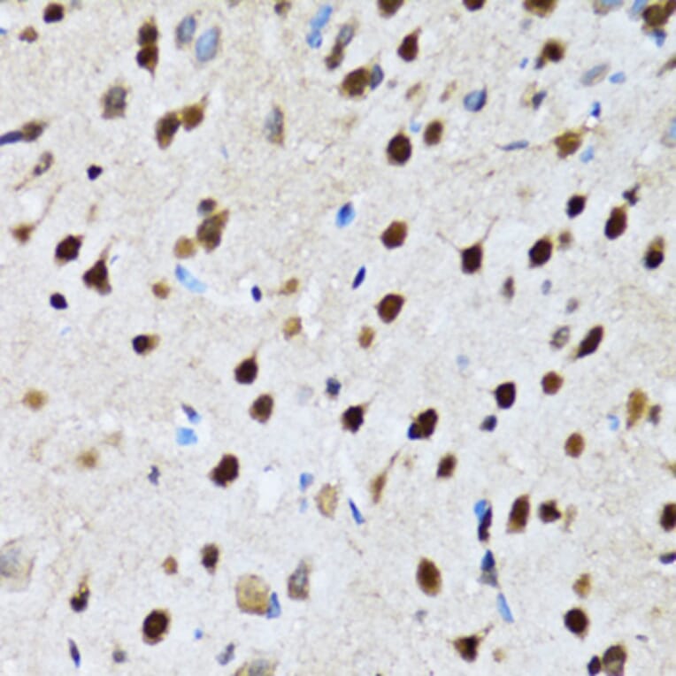 Immunohistochemistry - Anti-DBC-1 Antibody (A15555) - Antibodies.com