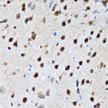 Immunohistochemistry - Anti-DBC-1 Antibody (A15555) - Antibodies.com