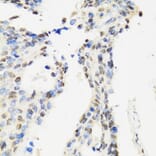 Immunohistochemistry - Anti-DBC-1 Antibody (A15555) - Antibodies.com