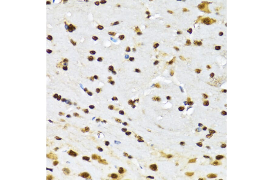 Immunohistochemistry - Anti-DBC-1 Antibody (A15555) - Antibodies.com