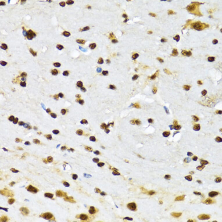 Immunohistochemistry - Anti-DBC-1 Antibody (A15555) - Antibodies.com