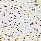 Immunohistochemistry - Anti-DBC-1 Antibody (A15555) - Antibodies.com