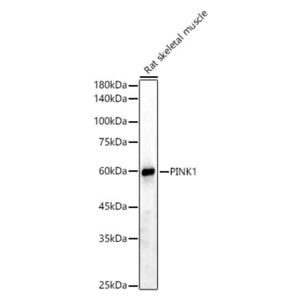 Western Blot - Anti-PINK1 Antibody (A15557) - Antibodies.com