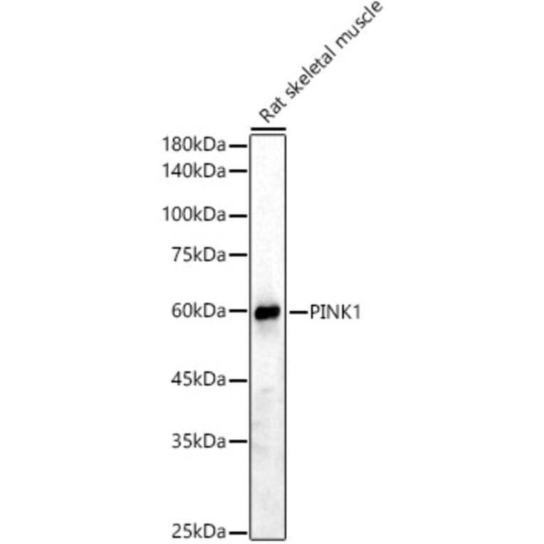 Western Blot - Anti-PINK1 Antibody (A15557) - Antibodies.com
