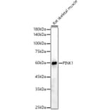 Western Blot - Anti-PINK1 Antibody (A15557) - Antibodies.com