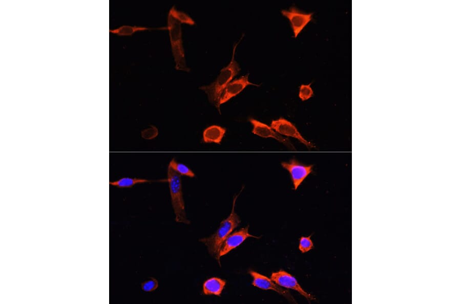 Immunofluorescence - Anti-PINK1 Antibody (A15557) - Antibodies.com