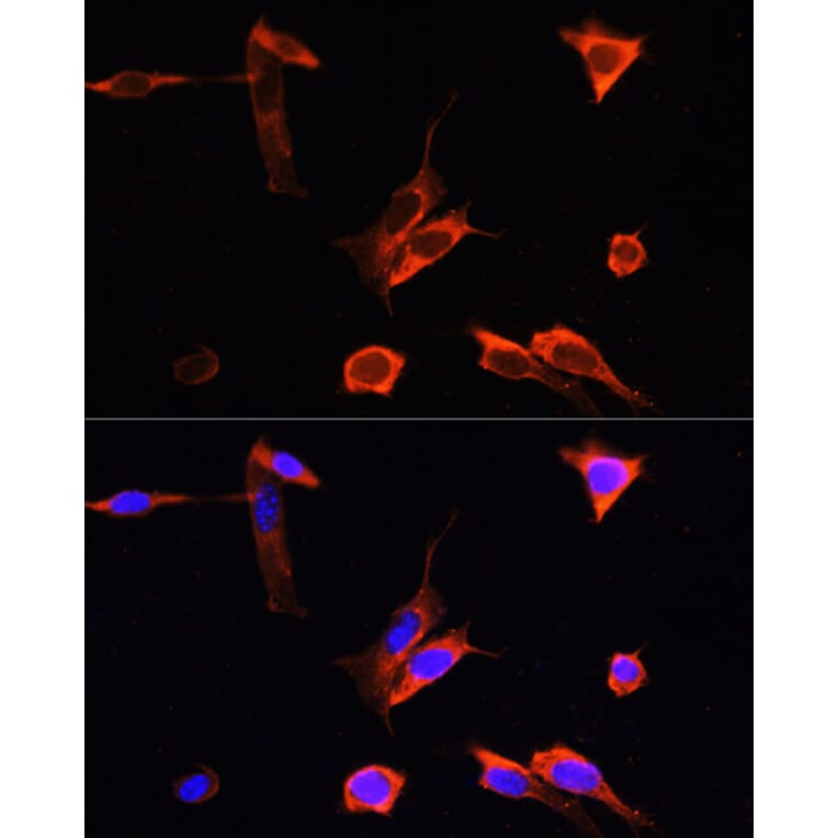 Immunofluorescence - Anti-PINK1 Antibody (A15557) - Antibodies.com
