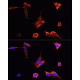 Immunofluorescence - Anti-PINK1 Antibody (A15557) - Antibodies.com