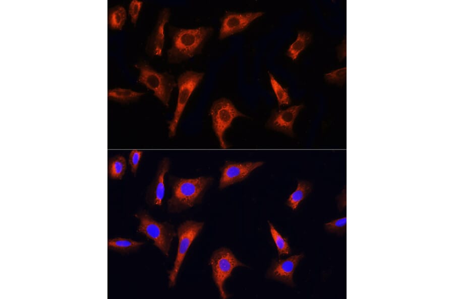 Immunofluorescence - Anti-PINK1 Antibody (A15557) - Antibodies.com