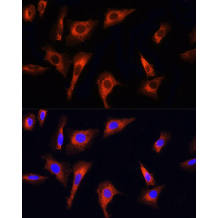 Immunofluorescence - Anti-PINK1 Antibody (A15557) - Antibodies.com