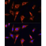 Immunofluorescence - Anti-PINK1 Antibody (A15557) - Antibodies.com