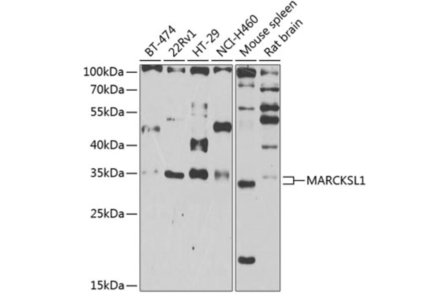 Western Blot - Anti-MARCKS like protein Antibody (A15558) - Antibodies.com