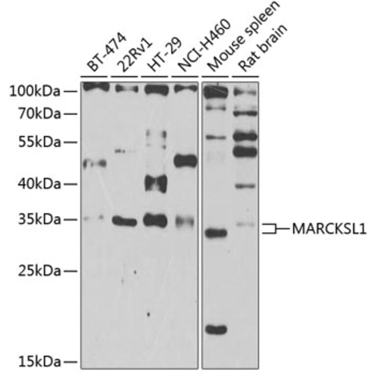 Western Blot - Anti-MARCKS like protein Antibody (A15558) - Antibodies.com