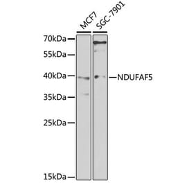 Western Blot - Anti-NDUFAF5 Antibody (A15559) - Antibodies.com