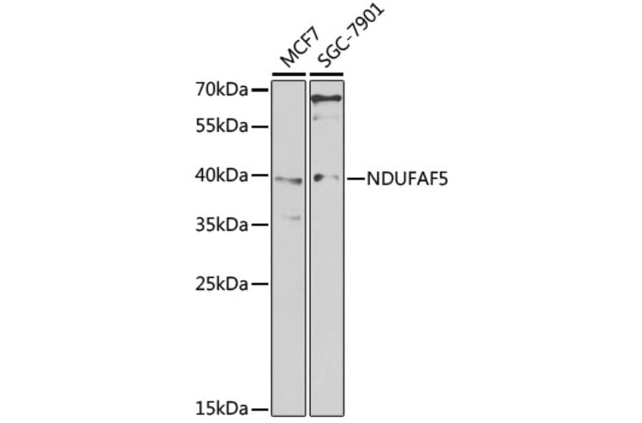 Western Blot - Anti-NDUFAF5 Antibody (A15559) - Antibodies.com