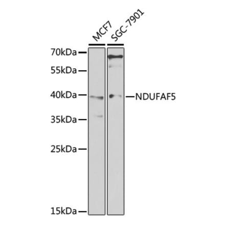 Western Blot - Anti-NDUFAF5 Antibody (A15559) - Antibodies.com