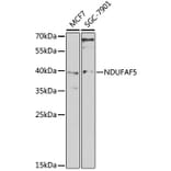 Western Blot - Anti-NDUFAF5 Antibody (A15559) - Antibodies.com