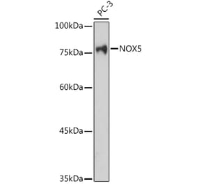 Western Blot - Anti-NOX5 Antibody (A15560) - Antibodies.com
