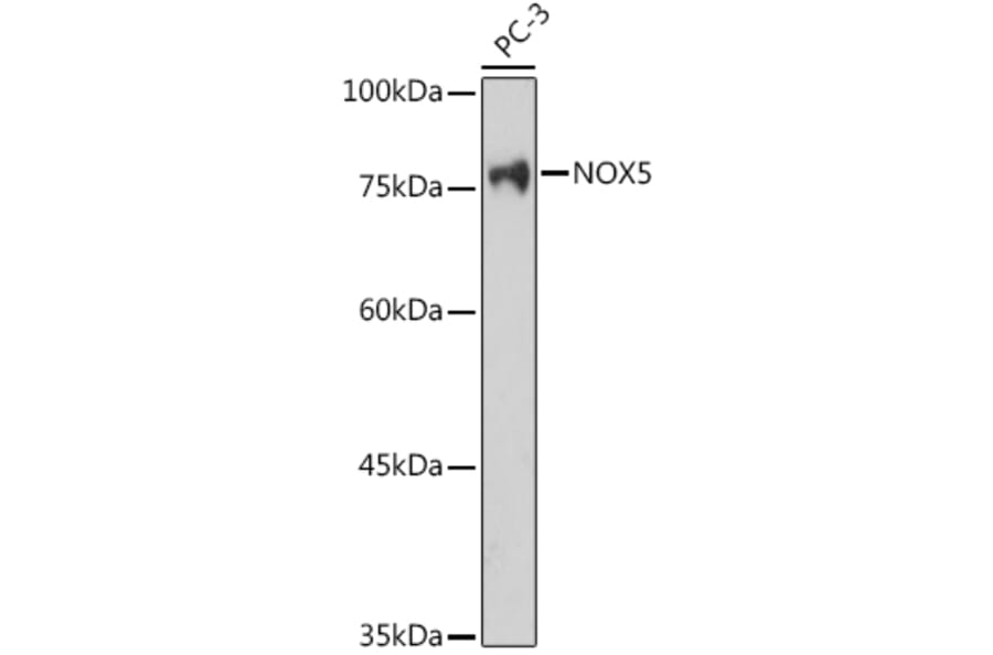 Western Blot - Anti-NOX5 Antibody (A15560) - Antibodies.com