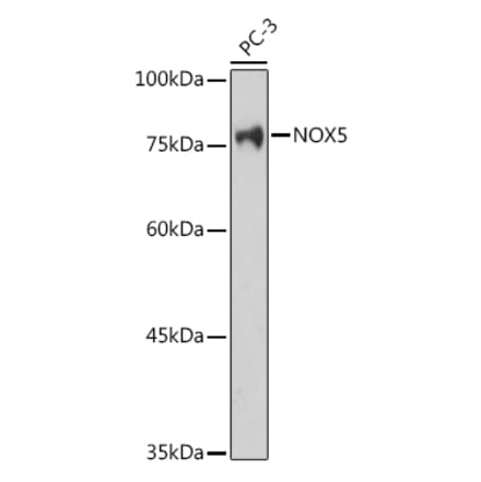 Western Blot - Anti-NOX5 Antibody (A15560) - Antibodies.com