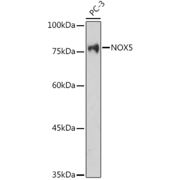 Western Blot - Anti-NOX5 Antibody (A15560) - Antibodies.com