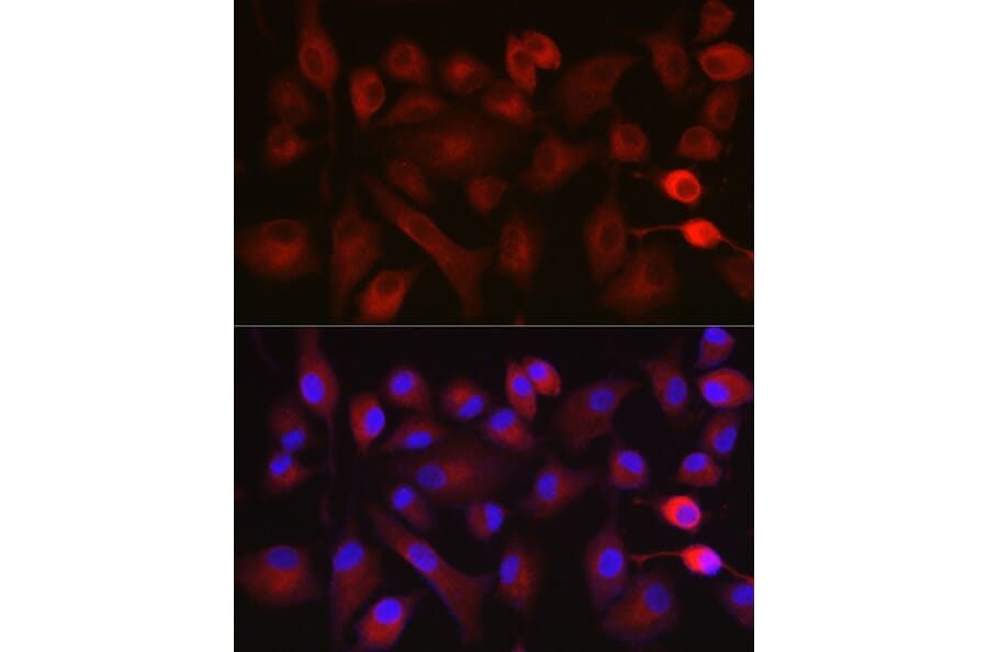 Immunofluorescence - Anti-NOX5 Antibody (A15560) - Antibodies.com