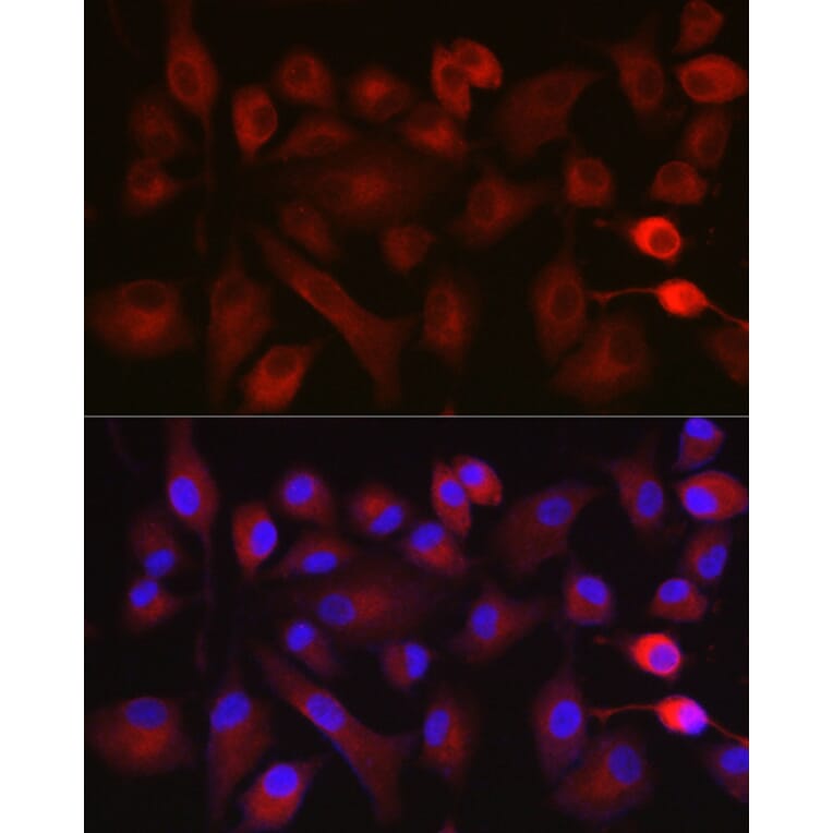 Immunofluorescence - Anti-NOX5 Antibody (A15560) - Antibodies.com